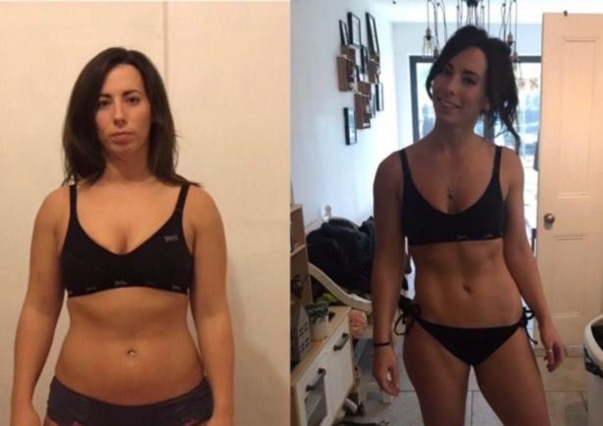 Patricia before en after met Ozentra